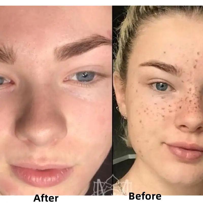 Turmeric Face Whitening Serum - MANDOTOS