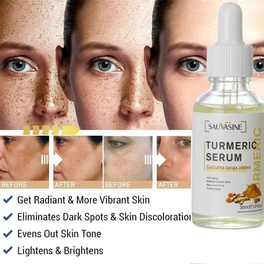 BrightGlow Turmeric Radiance Serum - Unleash Your Skin's Natural Glow - MANDOTOS