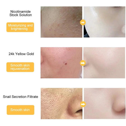 Gold Essence Hyaluronic Serum - MANDOTOS