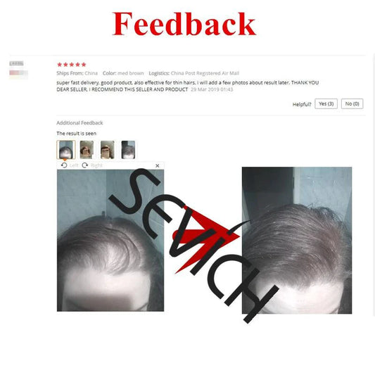Mandotos Keratin Hair Building Fibers in 25g, hair thickening powder for fuller, thicker hair with natural-looking coverage.