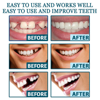 Adjustable Snap-On Dentures: Your Perfect Smile Solution - MANDOTOS