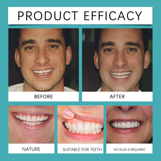 Adjustable Snap-On Dentures: Your Perfect Smile Solution - MANDOTOS
