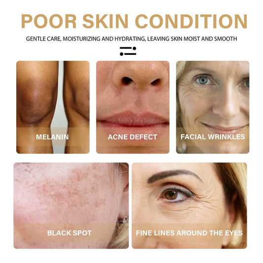 EELHOE Turmeric Dark Spot Correcting Serum Face Care Spot Moisturizing Nourishing Repairing Complexion Serum - MANDOTOS