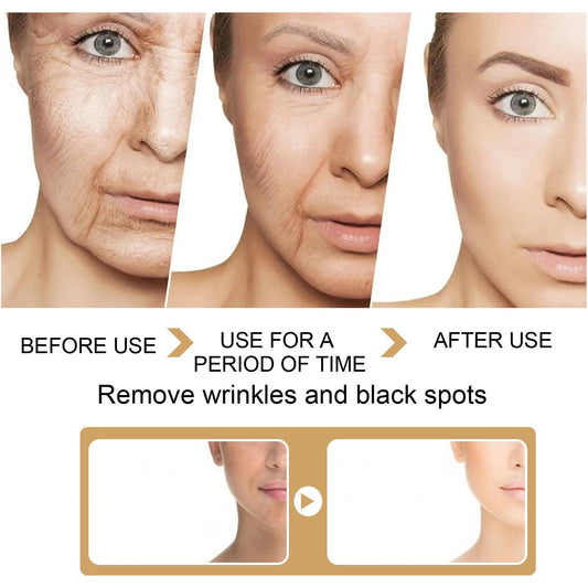 EELHOE Turmeric Dark Spot Correcting Serum Face Care Spot Moisturizing Nourishing Repairing Complexion Serum - MANDOTOS
