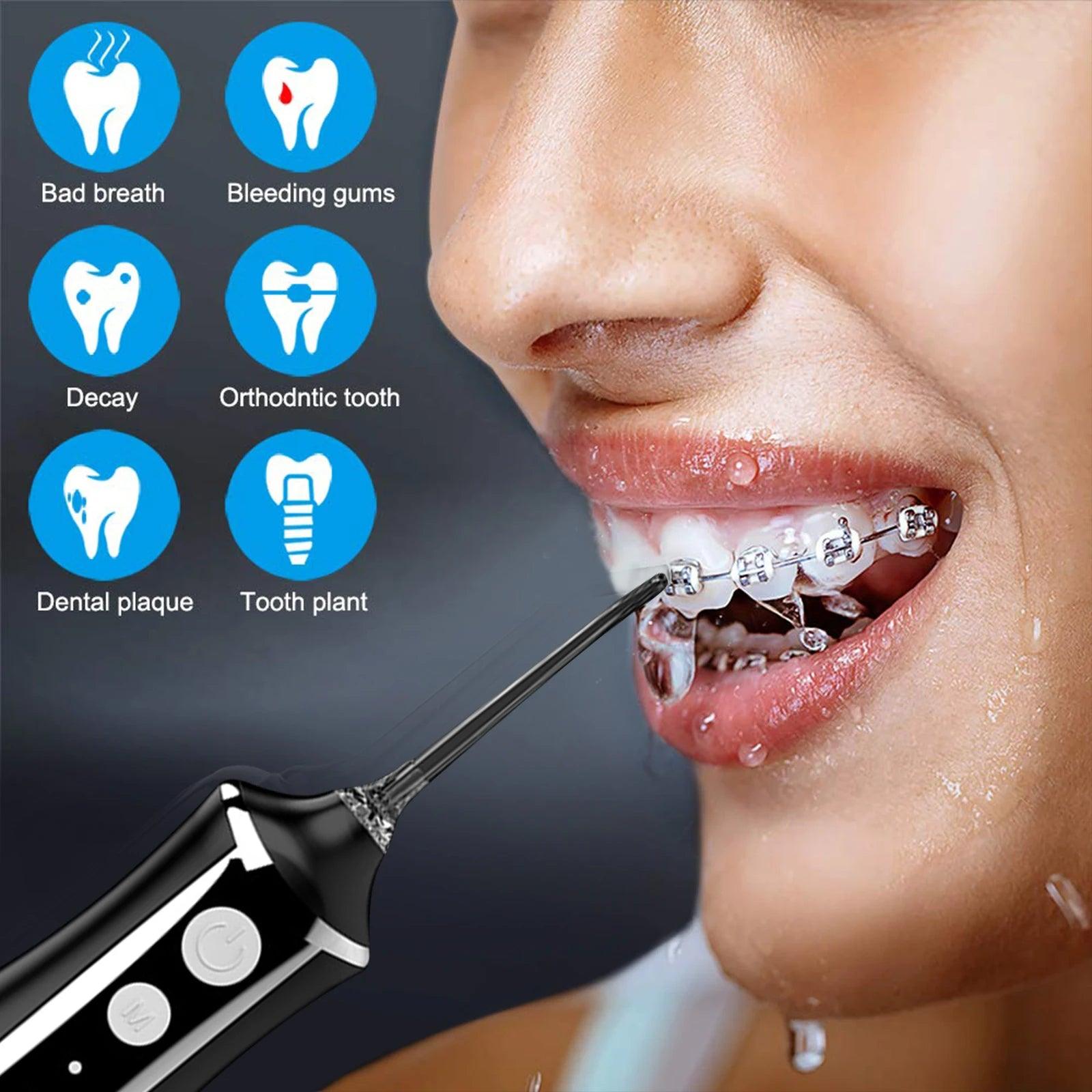 Fairywill Oral Irrigator Portable Water Flosser Dental Teeth Cleaning Waterproof USB Charge With 5 Jets For Braces, Travel - MANDOTOS