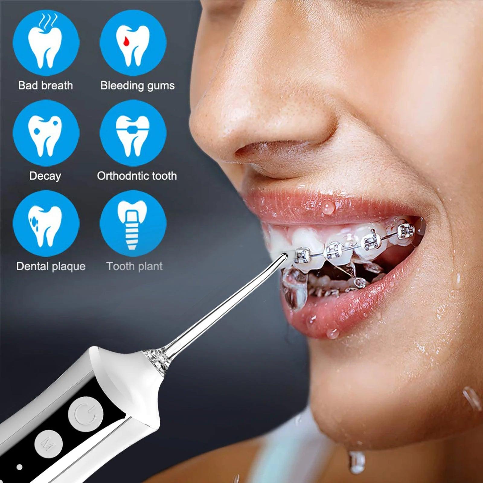 Fairywill Oral Irrigator Portable Water Flosser Dental Teeth Cleaning Waterproof USB Charge With 5 Jets For Braces, Travel - MANDOTOS