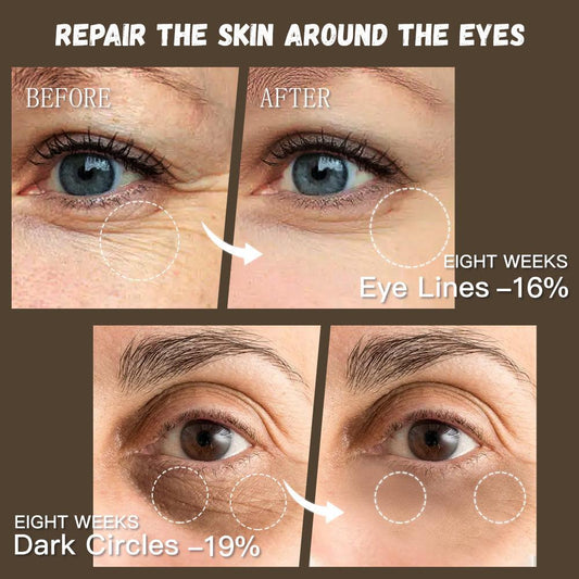 GUANJING Natural Skincare Retinol Eye Cream Vegan Organic Anti Aging Moisturizer Anti-wrinkle Skin Whitening Retinol Eye Cream - MANDOTOS