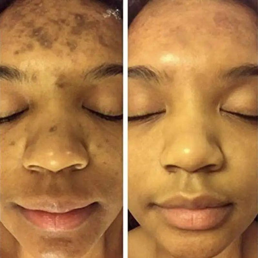 Turmeric Face Whitening Serum - MANDOTOS