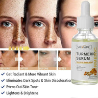 Mandotos BrightGlow Turmeric Radiance Serum bottle with gold accents, showcasing its packaging for glowing skin.