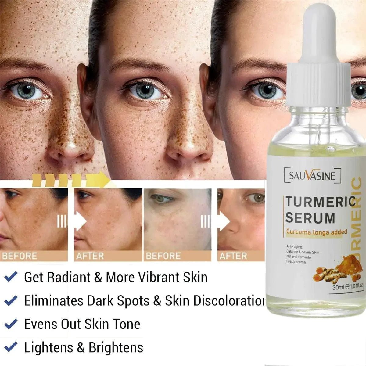 BrightGlow Turmeric Radiance Serum - Unleash Your Skin's Natural Glow - MANDOTOS