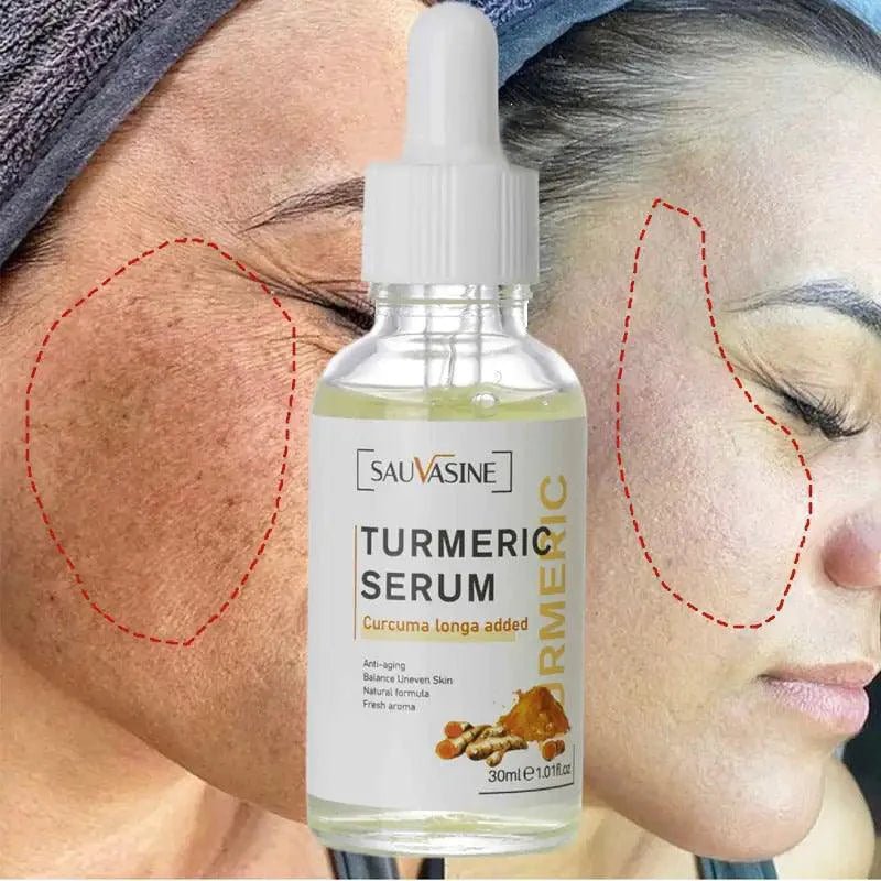 BrightGlow Turmeric Radiance Serum - Unleash Your Skin's Natural Glow - MANDOTOS