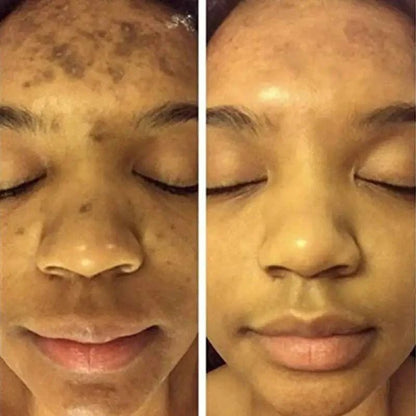 BrightGlow Turmeric Radiance Serum - Unleash Your Skin's Natural Glow - MANDOTOS