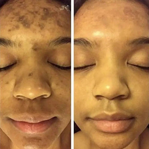 BrightGlow Turmeric Radiance Serum - Unleash Your Skin's Natural Glow - MANDOTOS
