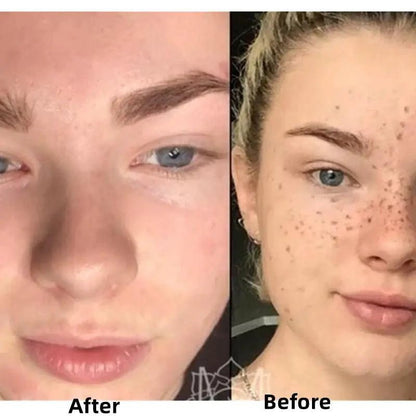 BrightGlow Turmeric Radiance Serum - Unleash Your Skin's Natural Glow - MANDOTOS