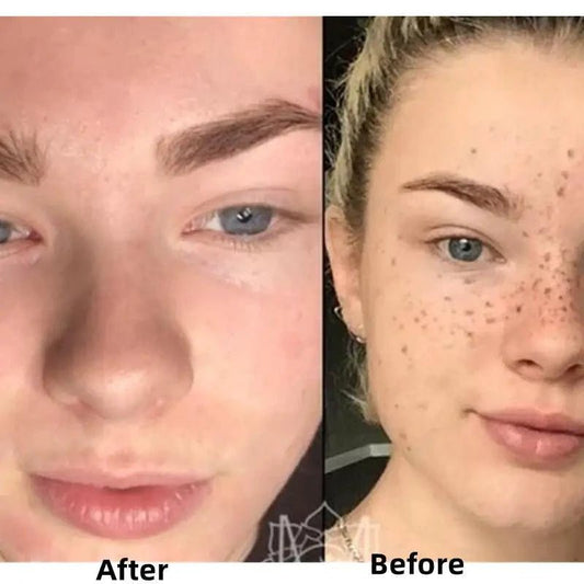 BrightGlow Turmeric Radiance Serum - Unleash Your Skin's Natural Glow - MANDOTOS