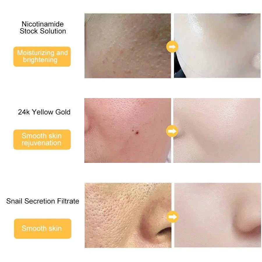 Gold Essence Hyaluronic Serum - MANDOTOS