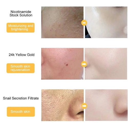 Gold Essence Hyaluronic Serum - MANDOTOS