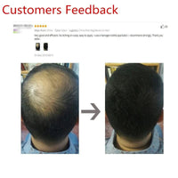 Mandotos Keratin Hair Building Fibers in 25g container, thickening powder for fuller hair appearance.