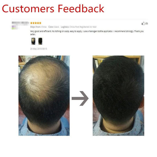 Mandotos Keratin Hair Building Fibers in 25g container, thickening powder for fuller hair appearance.