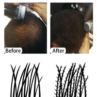 Mandotos keratin hair building fibers in 25g container, thickening powder for fuller, natural-looking hair.