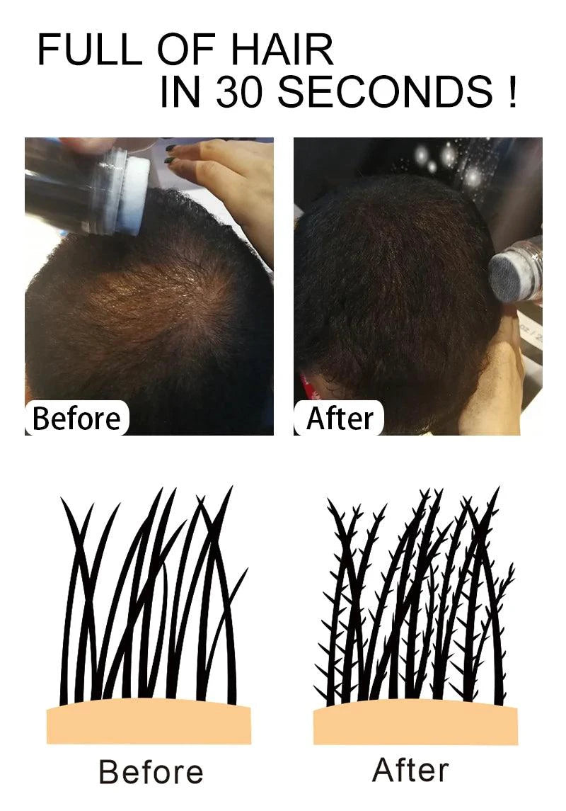 Hair Building Fibers Keratin Thicker Anti Hair Loss Products Concealer Refill Thickening Hair Fiber Powders Growth sevich 25g - MANDOTOS