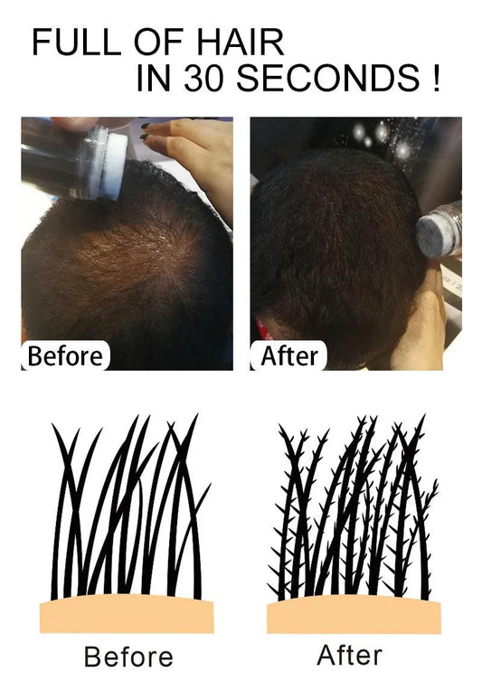 Mandotos keratin hair building fibers in 25g container, thickening powder for fuller, natural-looking hair.