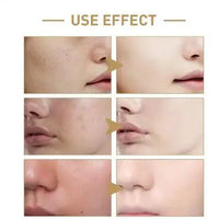 Mandotos Rice Face Toner with hydrating and moisturizing properties, showing a clear bottle of toner with rice extract.
