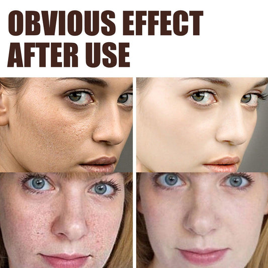 Retinol Anti Aging Wrinkle Removal Skin Firming Cream, EELHOE Retinol Cream Anti-Aging With Hyaluronic Acid And Vitamin - MANDOTOS