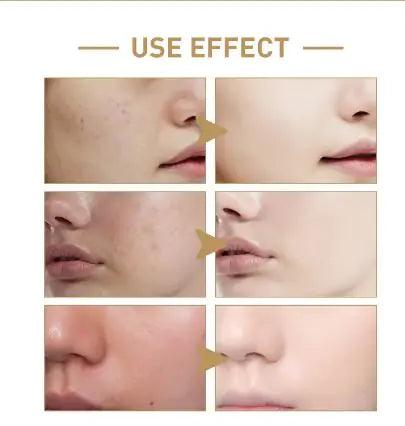 Rice Face Toner - Hydrating & Moisturizing - MANDOTOS